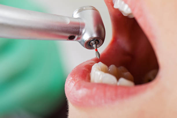 Emergency Gum Pain Relief in KS
